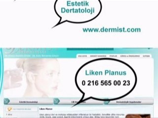 Liken Planus / www.dermist.com