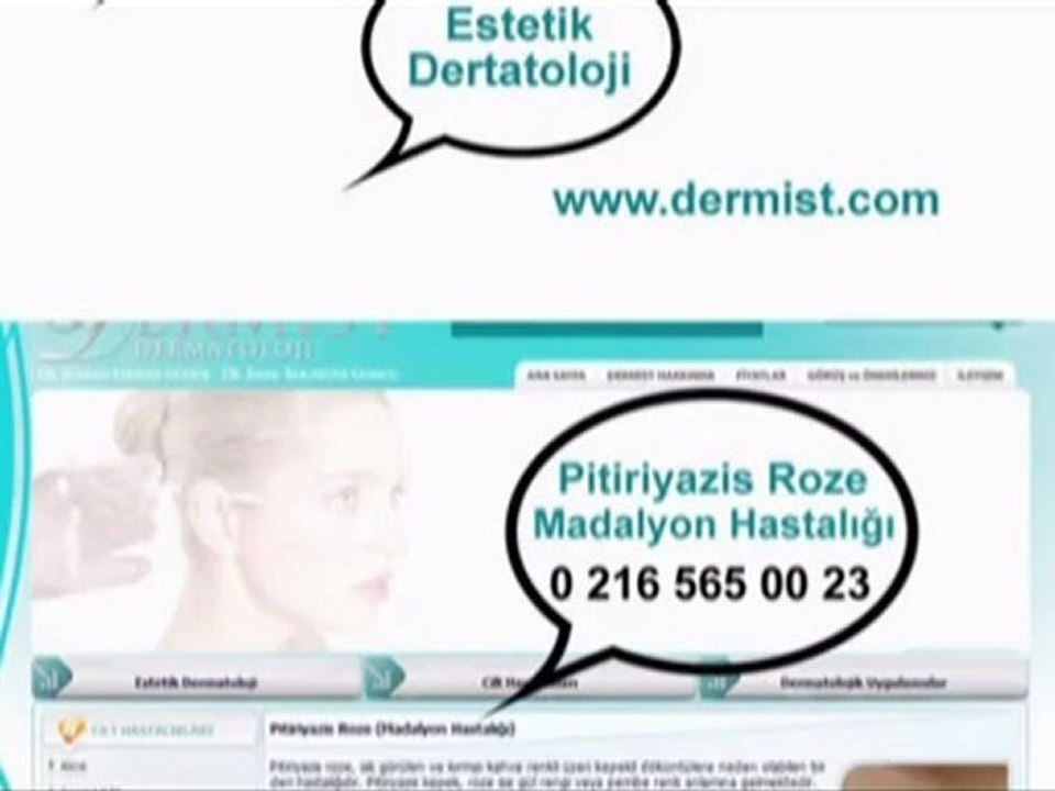 Madalyon Hastaligi (Pitiriyazis Roze) / www.dermist.com