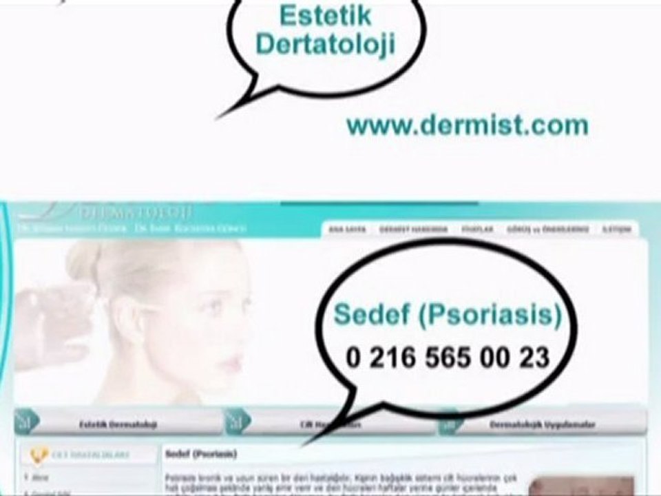 Sedef (Psoriasis) / www.dermist.com
