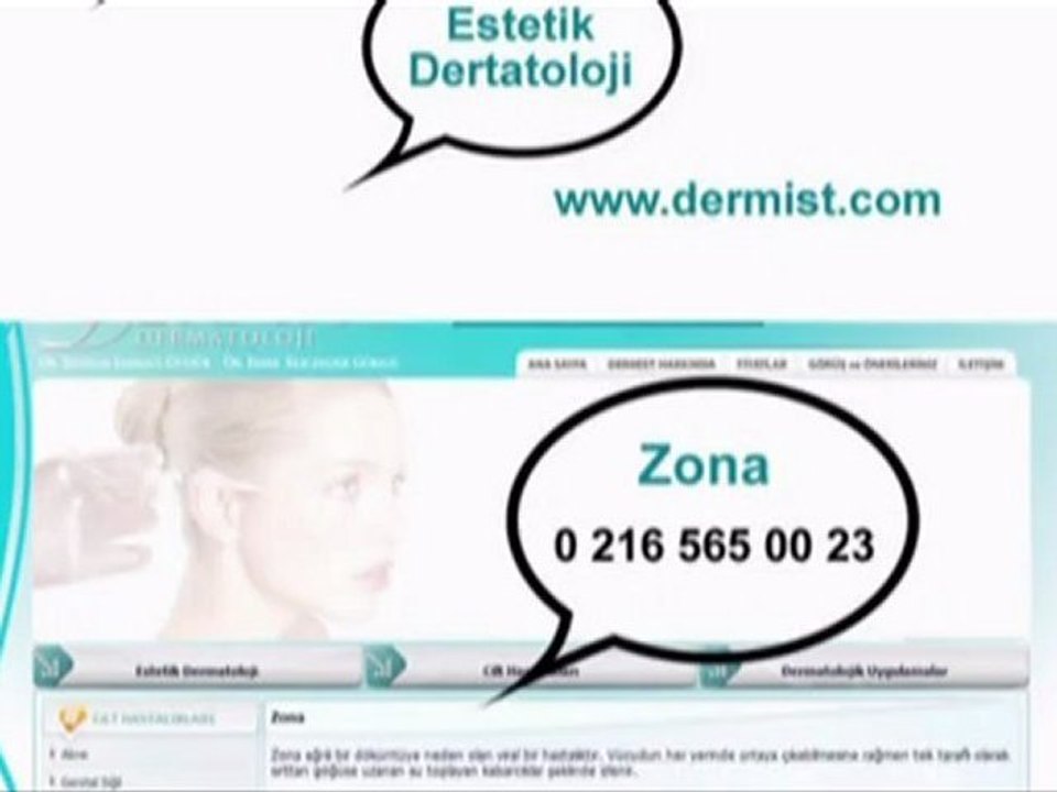 Zona / www.dermist.com
