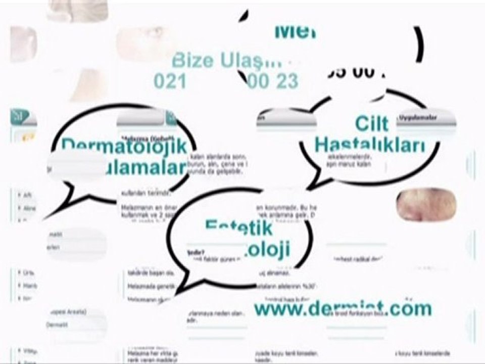 Melazma / www.dermist.com