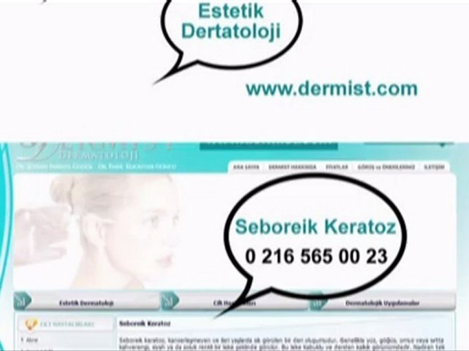 Seboreik Keratoz / www.dermist.com