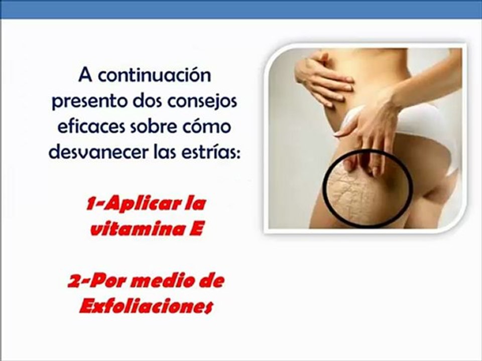 Como Desvanecer Las Estrias - Eliminar las estrias rapidamente