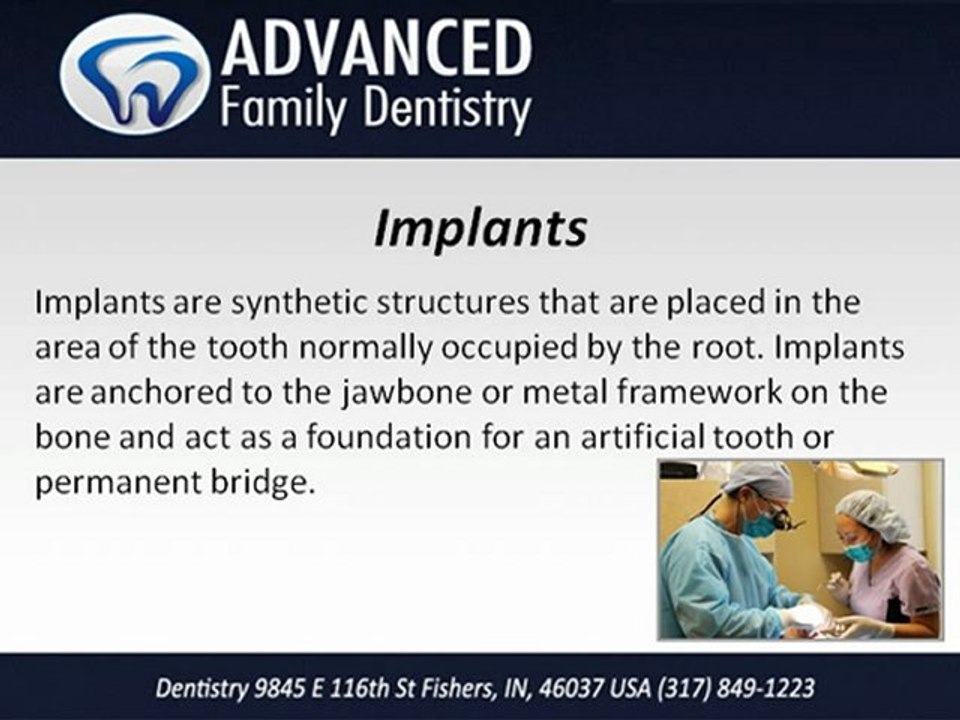 Dentists In Indianapolis | Fishers Indiana Dentist