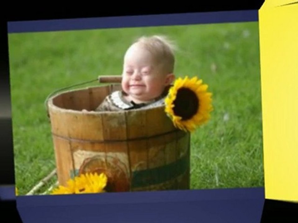 Down Syndrome -- Information and Its Definition - Down Syndrome Help