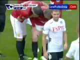 Injured Rooney