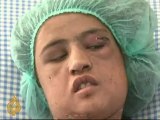 Afghan child bride tortured for six months