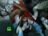 Video: 40 killed in Yemen violence, hundreds injured