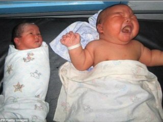 أكبر مولود في العالم The world's largest live