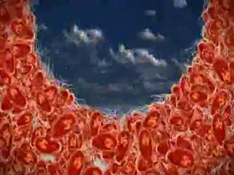 Cleansing for the HCG Diet. Detoxify the Colon.