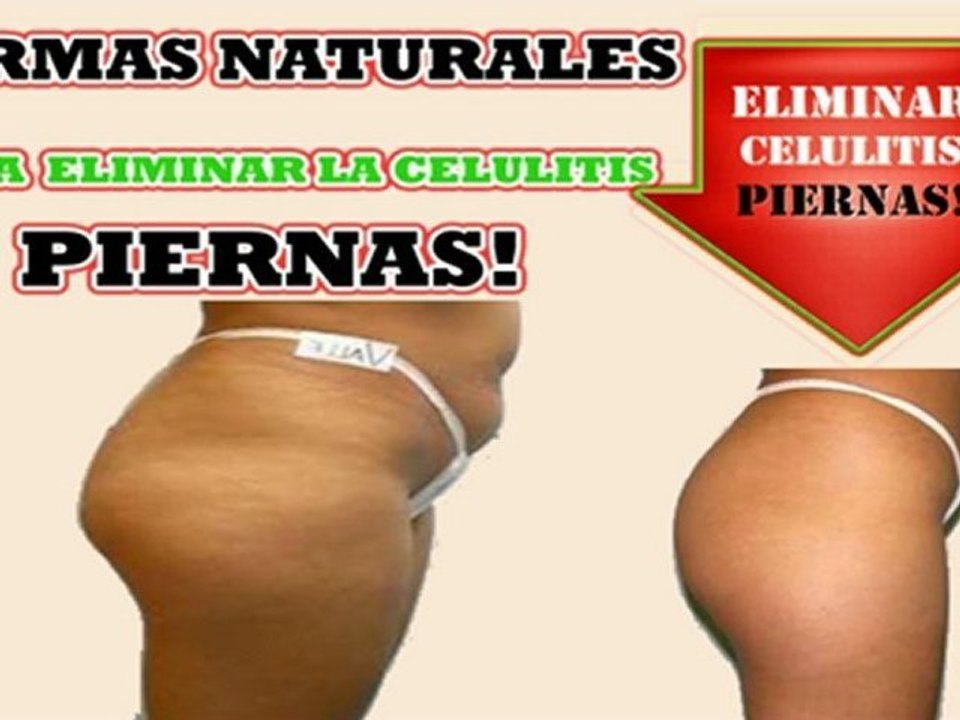 Como Eliminar la celulitis de manera definitiva-tratamientos contra celulitis