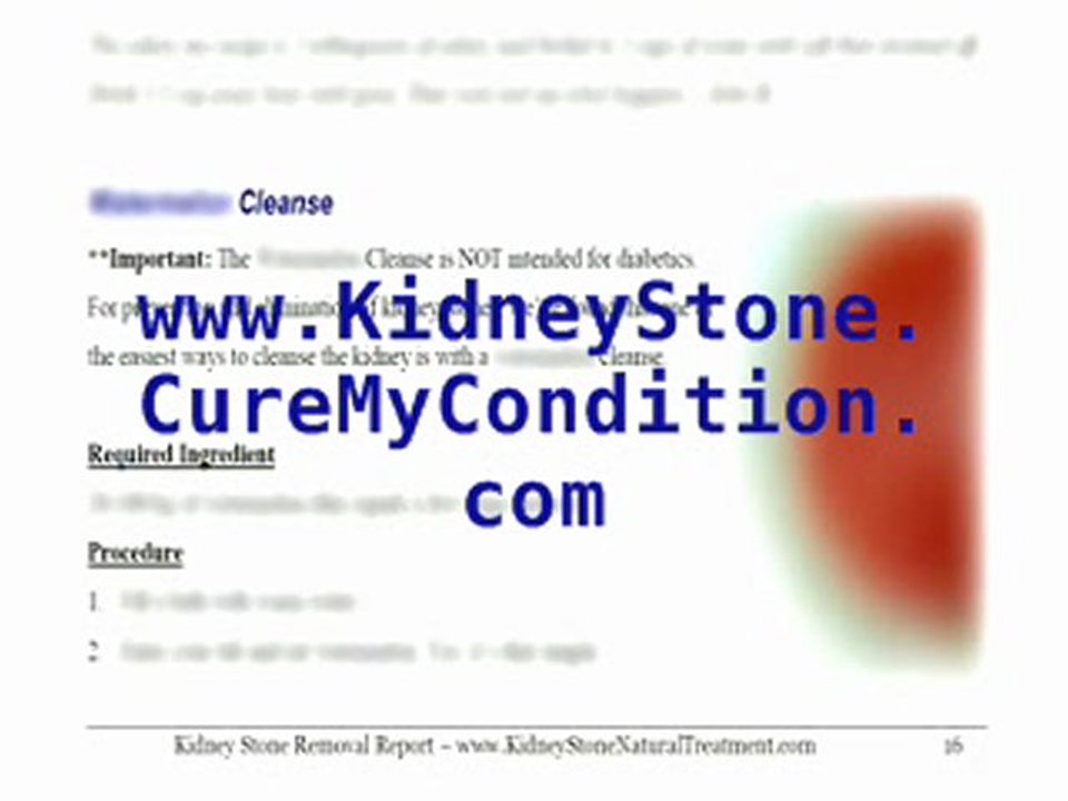 How To Dissolve And Pass Out Kidney Stones At Home By Drinking These Two Common Household Ingredients - And Avoid Kidney Stone Removal Surgery