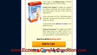 How to cure eczema permanently and naturally without relying on steroids and immune suppressing drugs - Best treatment option for childhood eczema and chronic eczema