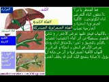 Cholangite Sclérosante Primitive-Version en arabe -Dr. AMINE A Maroc
