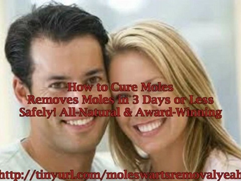 How to remove moles