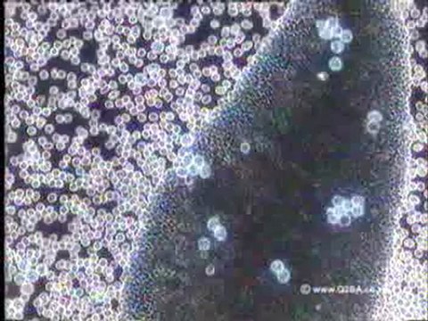 Radiation Increased Cancer Risk (Radiation Meters) Radiation Increased Cancer Risk