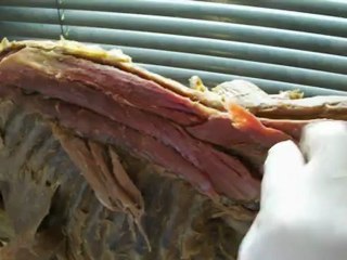 Anato I Musculos Erectores espinales