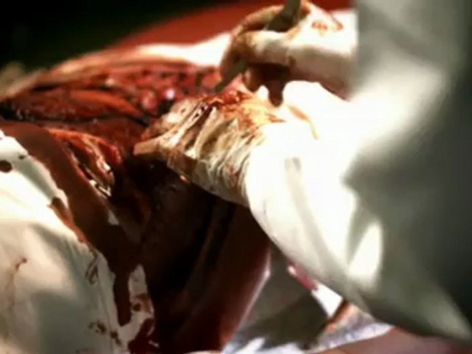 Autopsy 2