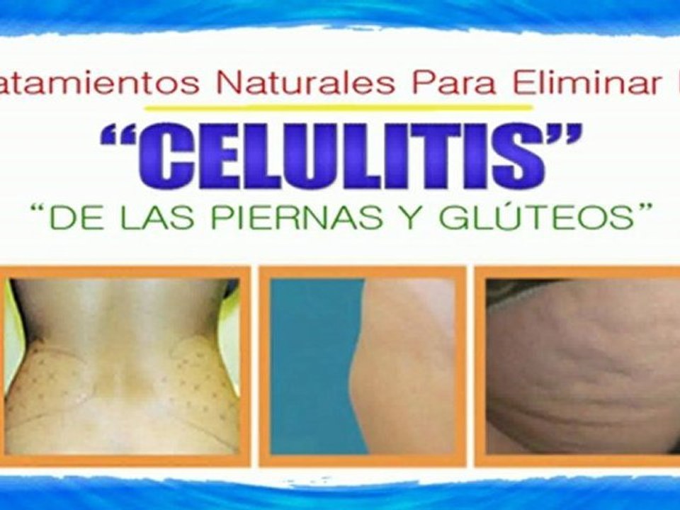 Como Eliminar Celulitis y estrias-[Eliminacion Celulitis]