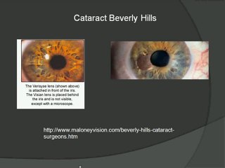 Lasik in Beverly Hills – Regain your Vision