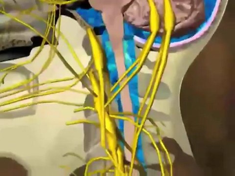 Pneumococcal Meningitis (Understanding Disease: Infectious Diseases & Oncology)