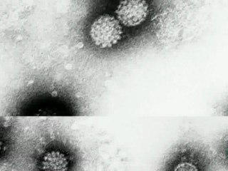 Cancer virico: Papiloma humano (Harald Zur Hausen)