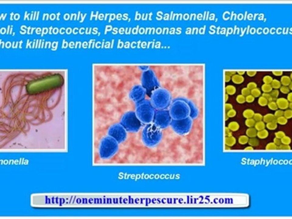 herpes simplex 2 - herpes simplex virus - herpes simplex treatment