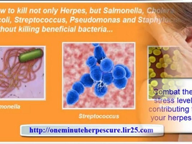 treatment of herpes – natural herpes treatment – herpes labialis treatment