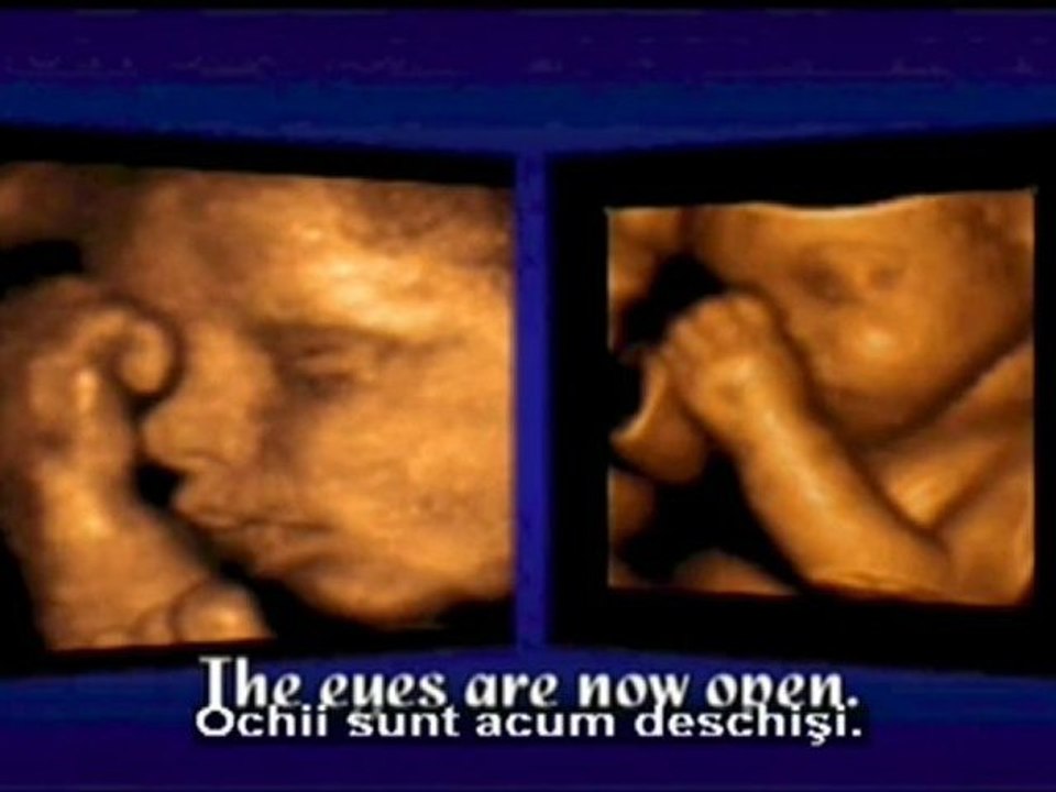 Martor ocular - Generaţia următoare (p.II)