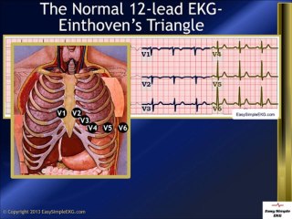 The Normal 12 Lead EKG and Einthoven's Triangle