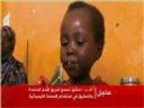 زبدة الفول السوداني لعلاج سوء التغذية