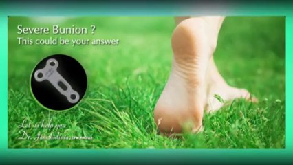 Choose the best surgeon for your "bunion removal"!