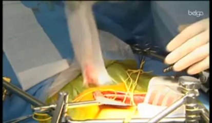 Transplantation : la Belgique manque de jeunes donneurs