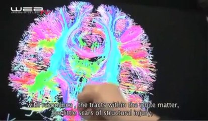 Expérience de mort imminente