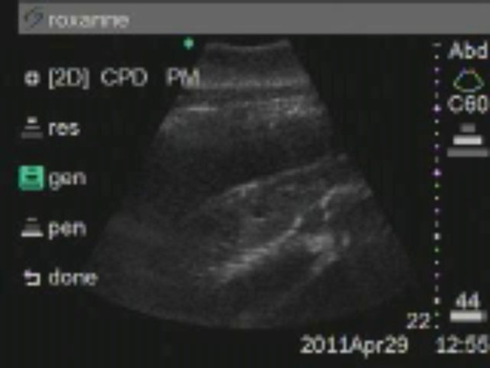 Au Delphinarium de Bruges: Roxanne, une femelle dauphin attend des jumeaux