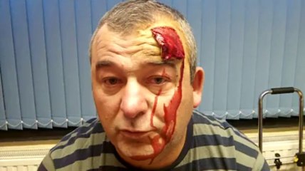 Deux "victimes volontaires" de la Croix-Rouge expliquent leurs blessures