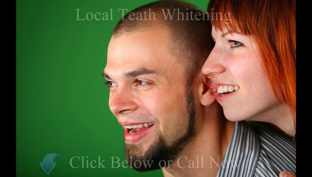 Teeth Whitening Dentist Saskatoon - Call (877)732-9136
