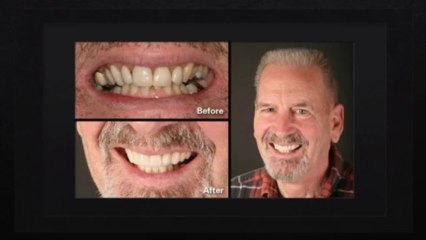 Sonoma Smiles Cosmetic Dentist- Santa Rosa, CA