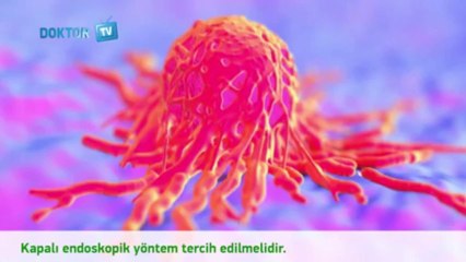 Yumurtalık Kistleri Nedir