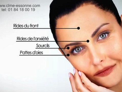 Acide Hyaluronique- Centre Epilation Laser & Médecine Esthétique - 91310 Montlhéry-Essonne