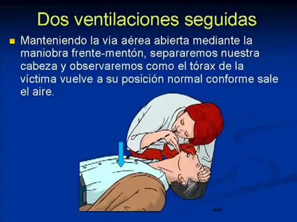 RCP BASICA   PASOS A SEGUIR