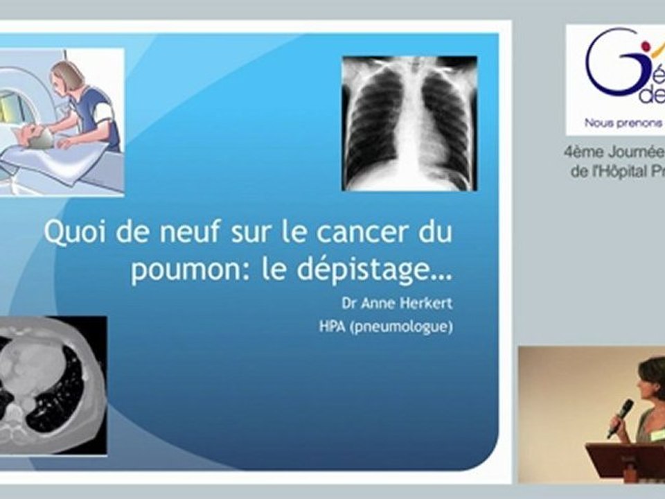 "Quoi de neuf sur le cancer du poumon, le dépistage" par le Docteur Herkert