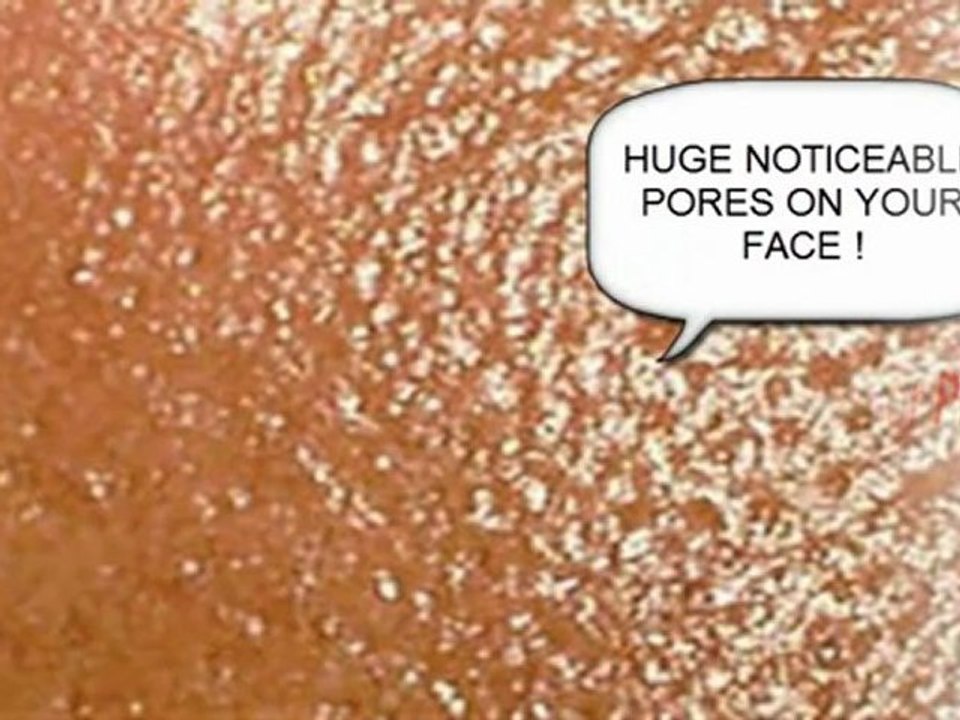 enlarged pores on face - skin pores - large skin pores