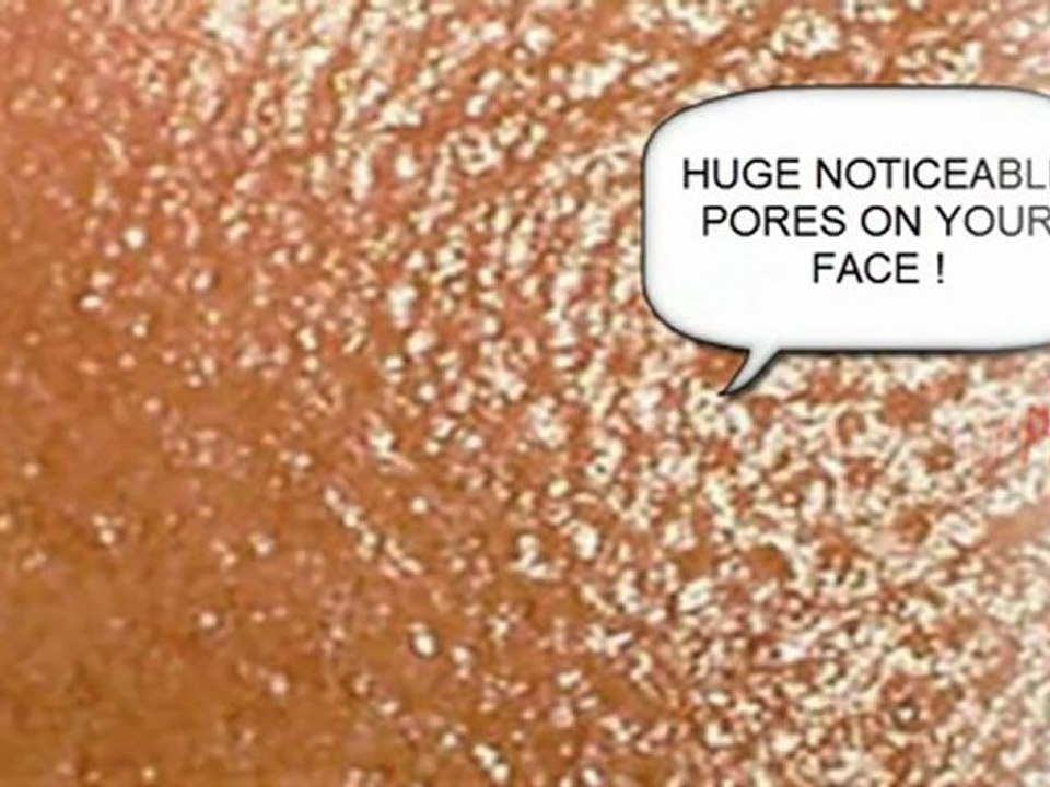 nose pores - pores on nose - large nose pores