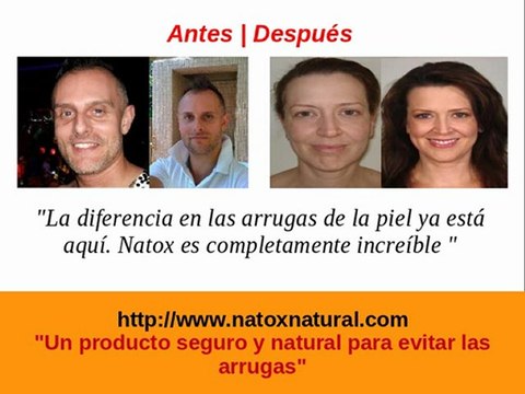 Natox prevenir las arrugas