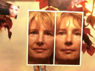 rhinoplasty portland oregon