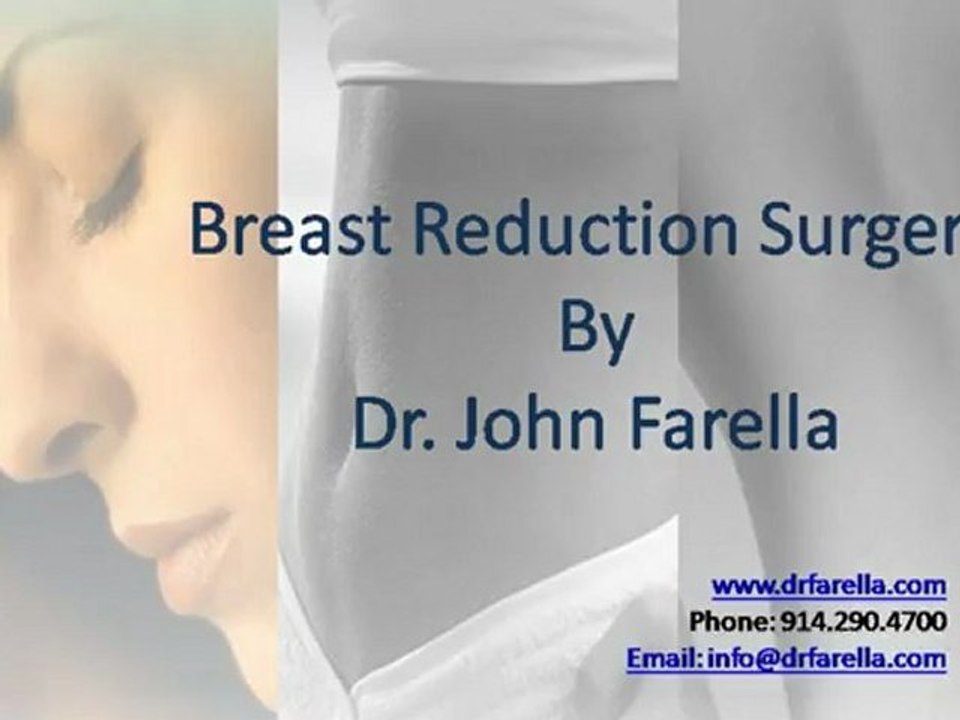 breast reduction surgery new york - by dr john farella
