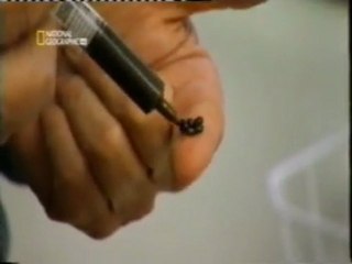 Aceite de cannabis contra la leucemia: Marihuana medicinal (Bob)