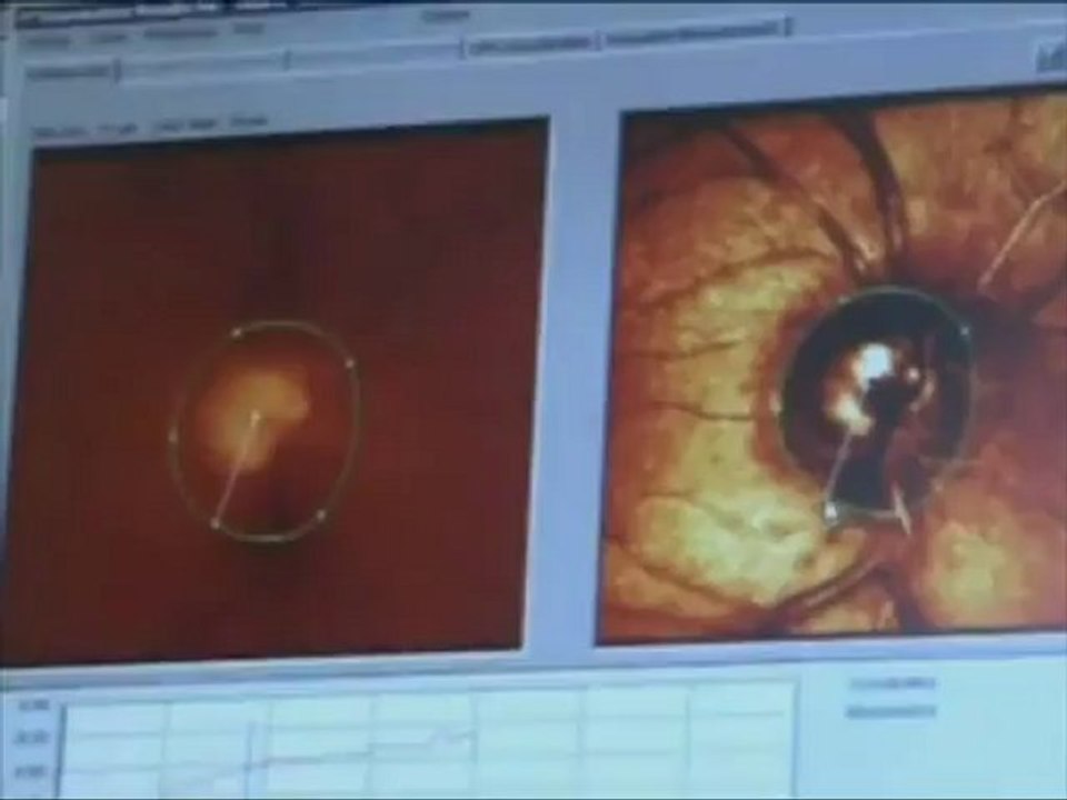 Augenklinik am Wittenbergplatz Berlin Schöneberg