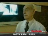 Kafasını 180 Derece Döndüren Adam